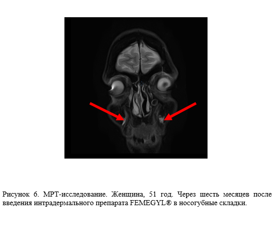 Снимок экрана (352).png